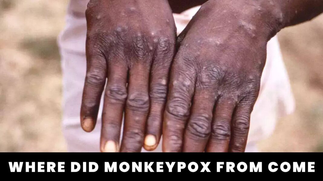 Where Did Monkeypox From Come